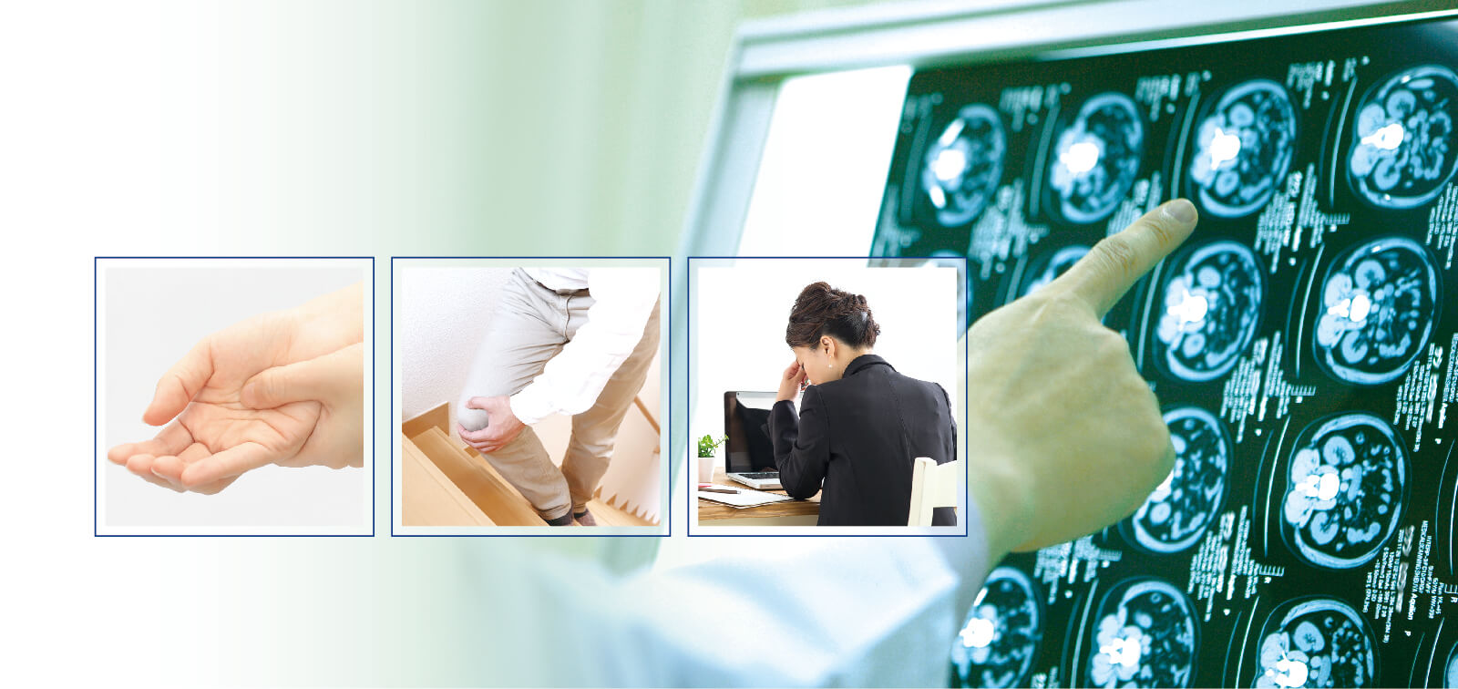 症状、疾患、脳神経外科イメージ